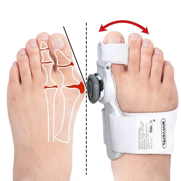 Alignix™ | Retrouver le confort de vos pieds