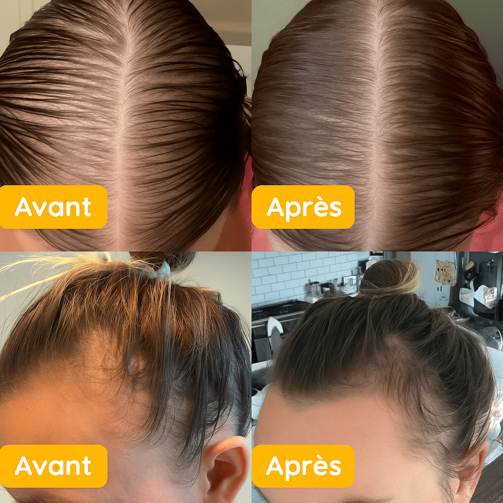 CheveuxForts™ | Retrouver confiance et éclat