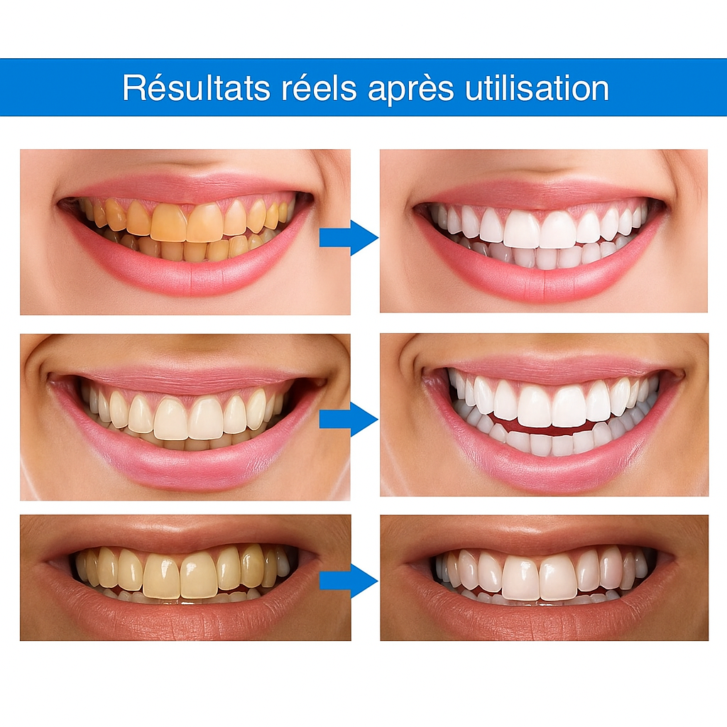 DentsBlancs™ | Sentez-vous confiant lorsque votre sourire reflète votre éclat !