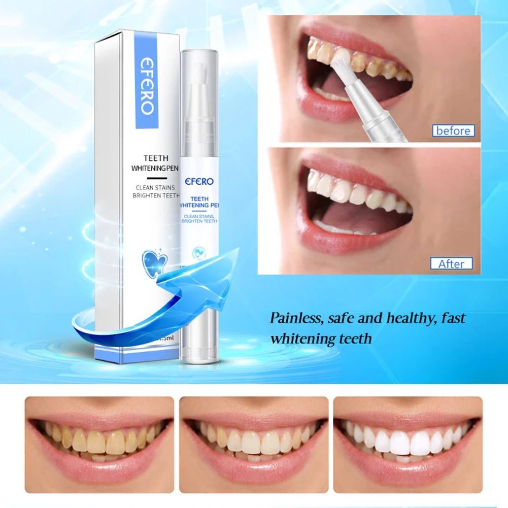 ÉclatDents™ | Sourire éclatant instantané - Madeluxe