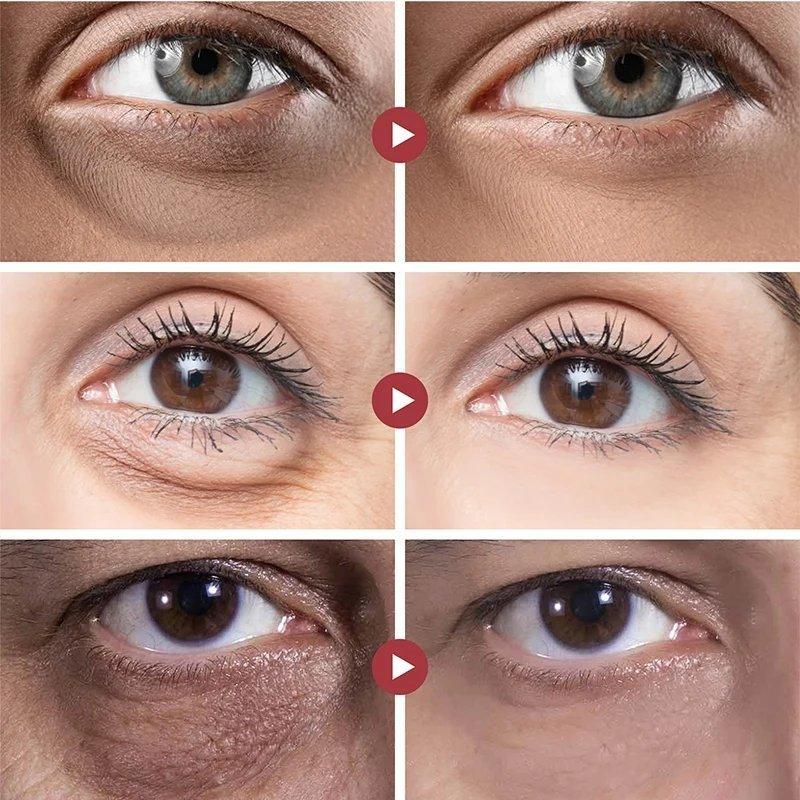 EyeLift™ | Pour une apparence vivante et plus jeune