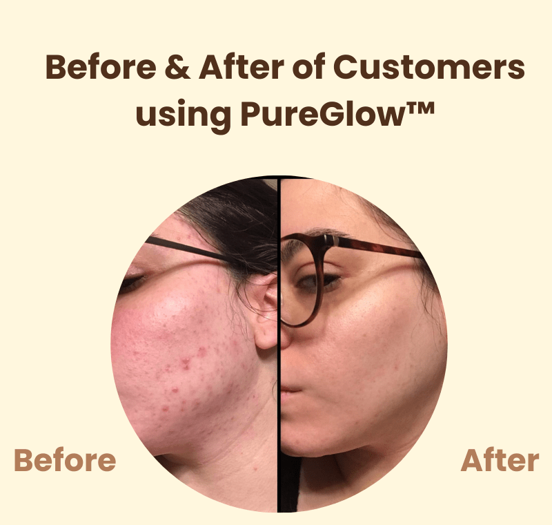 PureGlow™ | Éclat naturel et confiance retrouvée - Madeluxe