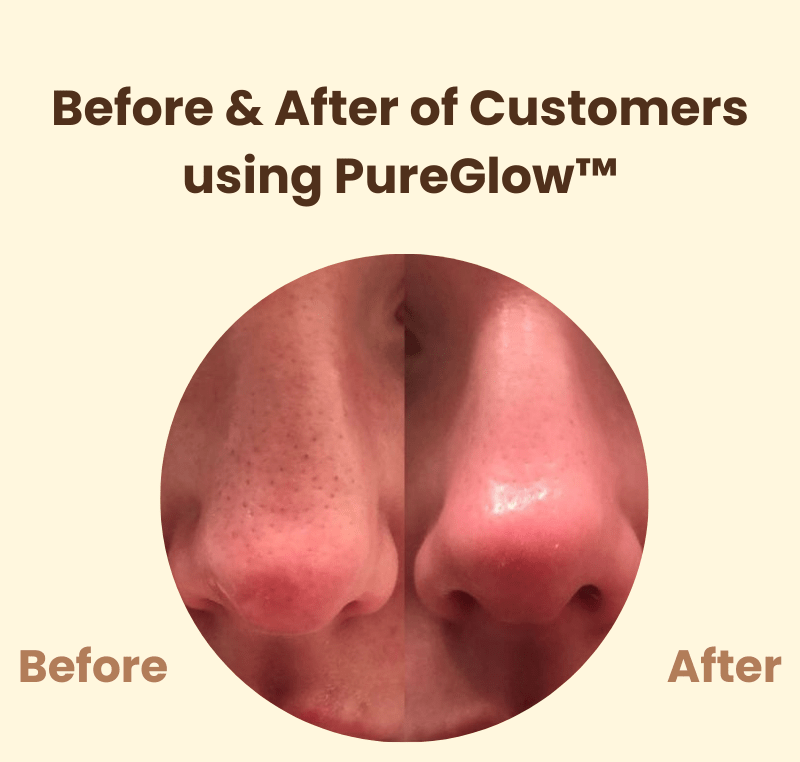 PureGlow™ | Éclat naturel et confiance retrouvée - Madeluxe