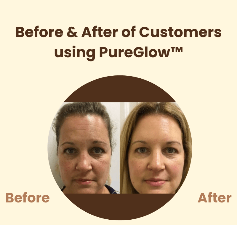 PureGlow™ | Éclat naturel et confiance retrouvée - Madeluxe