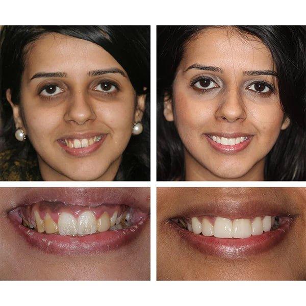 DentsBlancs™ | Sentez-vous confiant lorsque votre sourire reflète votre éclat !