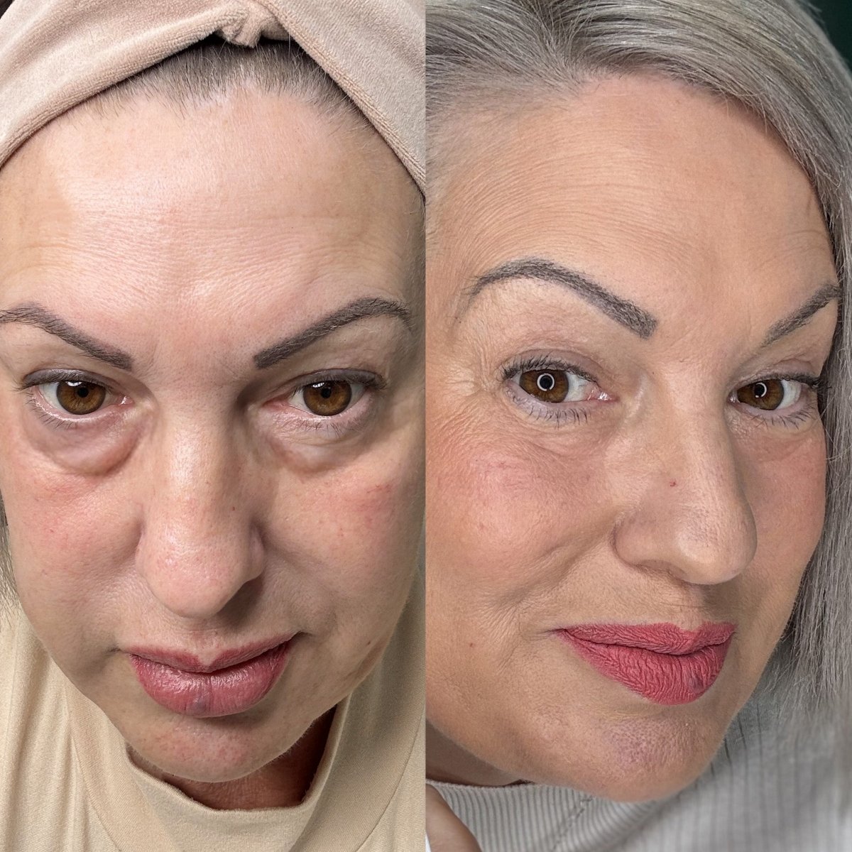 EyeRevive™ | Éclat et fraîcheur retrouvés - Madeluxe