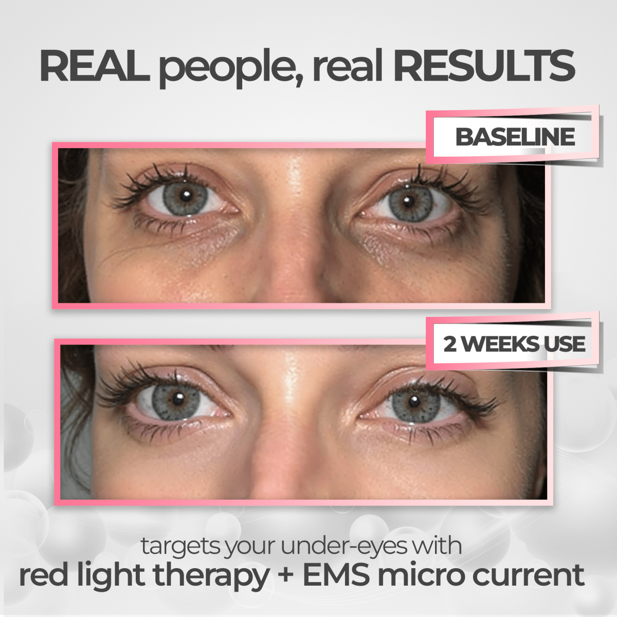 EyeRevive™ | Éclat et fraîcheur retrouvés - Madeluxe