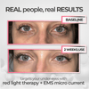 EyeRevive™ | Éclat et fraîcheur retrouvés - Madeluxe